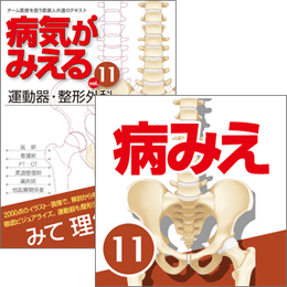 【医学生会員限定】病気がみえる vol.11運動器・整形外科(第1版)書籍+アプリセット