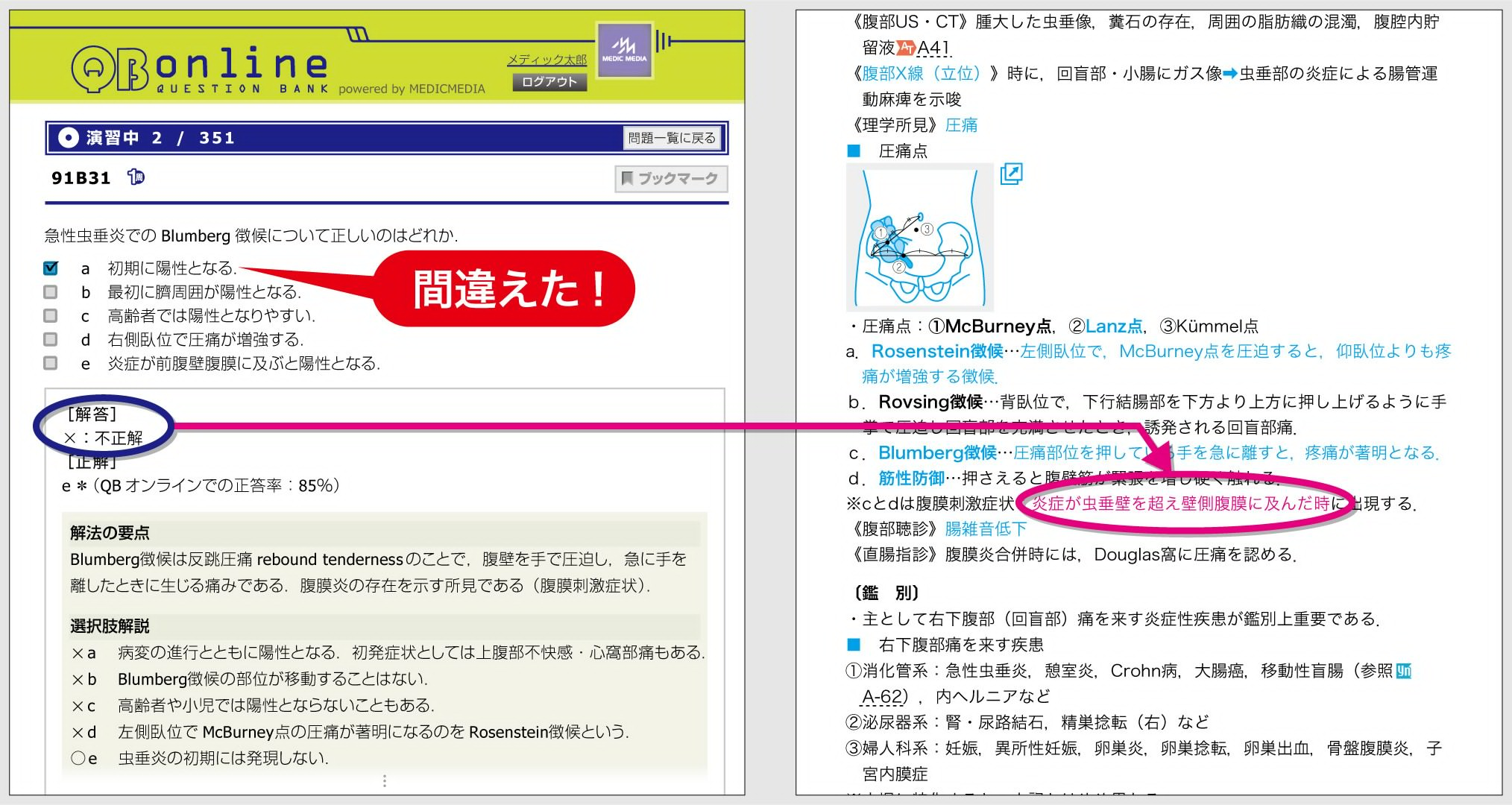 QBで解答を間違えると，YNの青字が赤字に！