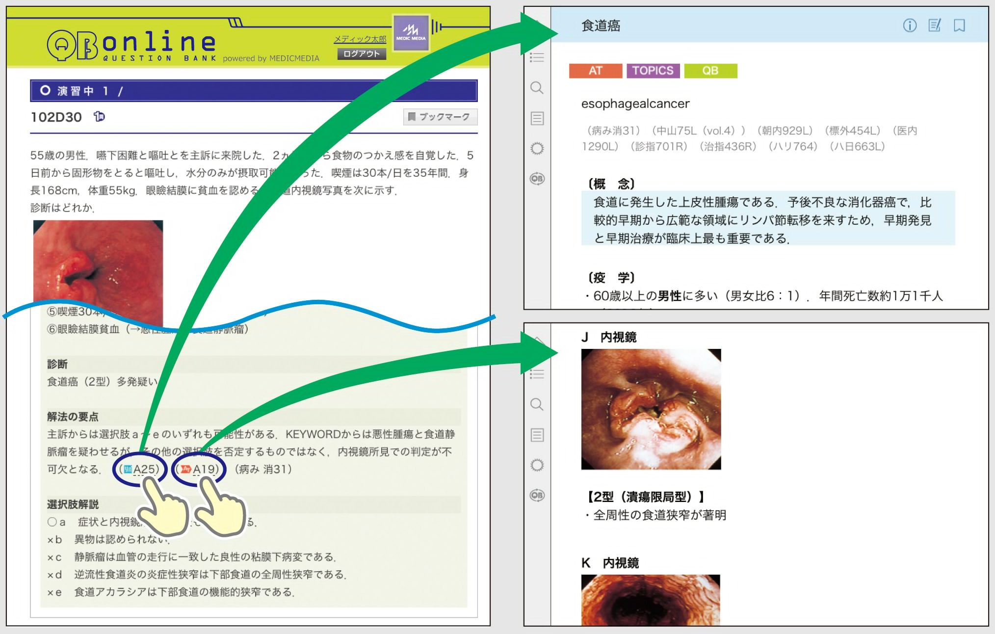 QBオンラインからのリンク